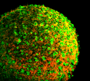 NePCs in neurospheres