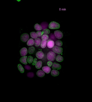 deconvolved histone and wf EGFP